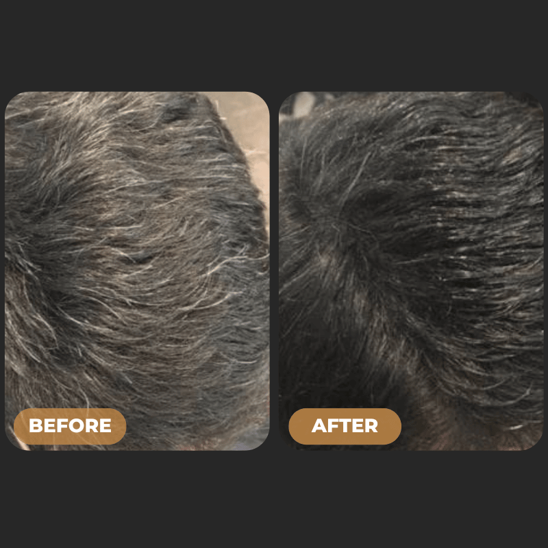 GrayAway™ Hair Revival Shampoo